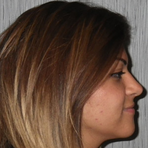 rivan_after_face_side_resting