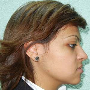 rivan_before_face_side_resting